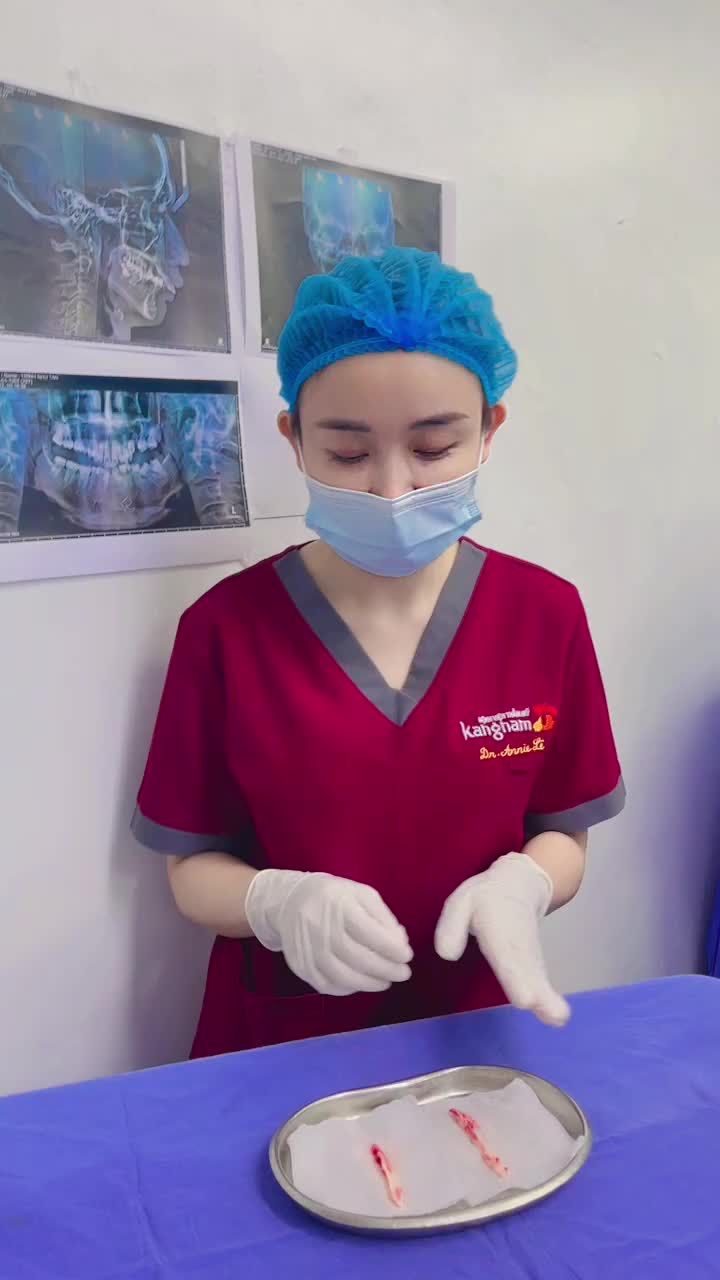 Hồi hộp cùng nghe bác sỹ phân tích phẫu hàm cho KH nam khắc phục tình trạng hàm do tai nạn giao thông